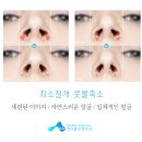 우아성형외과의원 이미지