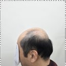 커트앤도트