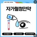 상은안경 | 4탄) 부산 투데이라섹 1년째 후기 -내돈내산, 꿀팁