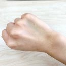 해맑음홈케어 | 장폐색 (장꼬임,장유착) 개복수술 후기 [5] 수술3개월후 검은변과 장출혈, 소장캡슐내시경