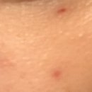 클린앤미피부과의원 이미지