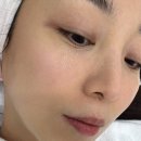오산피부관리 동탄 제이비비 플라즈마 관리 후기