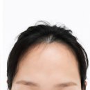 몽샴푸 | 두피가 금방 답답해지는 요즘, 지성두피샴푸 전문 몽잘바리스칼프스케일링샴푸로 바꿔본 후기