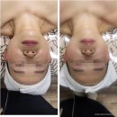 힐링 스파 이미지