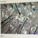 탈모케어 | 인천 송도 임산부 두피관리 [모바이오] 문제성 두피 각질 탈모 케어 후기