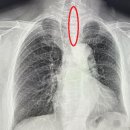 상인내과의원 네이버블로그