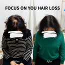 나는 소년이었다 SMP 이미지