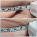 다미인피부비만관리 | 인천 청라 에스테틱 리바디라인에서 복부비만 탈출 후기