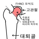 포메라니안 꼬마 FHNO (대퇴 골두 제거술) 수술 후기