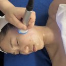 예담테라피 | 창원웨딩관리 얼굴윤곽받고 슬림라인 찾았어요!
