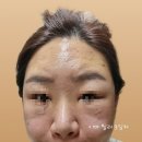 비티에프의원 이미지