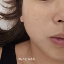 안산 부곡동피부관리 수빈에스테틱 멀티플라즈마/ 물방울관리 후기