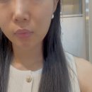 프라임 | 압구정피부과 울쎄라프라임 후기 | 내돈내산 볼패임 걱정 없는 리프팅 경험기