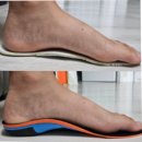 (주)인포메디 | 족저근막염 치료방법 깔창 추천 효과 후기 내돈내산