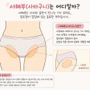 한라시그마관리 | [더스무스왁싱와이존테라피수원인계점]서혜부관리 받고 다리 가벼워진 후기