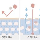 에이엘오