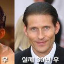 헤어크리스핀 이미지