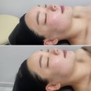 나경뷰티 | 부산 부암역 에스테틱 추천 서면윤곽관리 나경뷰티