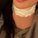 강남비비의원 | [강남비비의원] 목주름 필러 후기