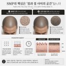 도트락강남 | 강남 두피문신 쉐도우도팅 — 일반 SMP와 결과가 갈리는 이유