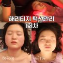 천안 신부동피부관리 사각턱 헤리티지 턱선 윤곽관리 1회차 후기 아인피부체형전문샵