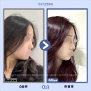 아우어성형외과의원 이미지