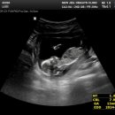 라라산부인과의원 이미지