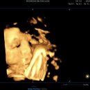 꼬꼬마옷장 | 임신 37-39주차 기록ㅣ출산휴가 시작, 막달 운동 효과 , 셀프 만삭사진, 제왕절개 소감