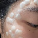 미앤필의원 네이버블로그