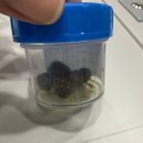 케이메디컬의원 | 인천 담낭절제술-성모케이외과의원 후기