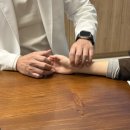 경화반점 이미지