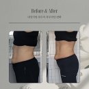 호이플랜