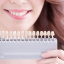 치아정밀치과기공소 이미지