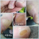 예꼼네일
