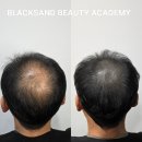 블랙샌드뷰티 이미지