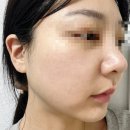 피부장벽강화 화장품 추천! 휴셀 NK CELL 겔 마스크팩 사용 후기