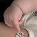 신소아청소년과의원 | N3. 아기 RSV(베이포투스) 예방접종 후기｜대구 파티마병원 비용