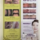 무아 플레이스 강남 피부관리 스킨플래닝 플라즈마
