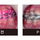 가나다치과의원 네이버블로그