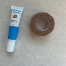 남대구요양병원 | 대구 더블유병원(w병원) 다지증, 합지증 수술 입원 후기 6. 퇴원 후 집에서의 생활/타병원 드레싱/실밥...