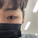 다래끼 제거 수술 후기, 붓기, 병원, 고통(신촌 엘리트안과)
