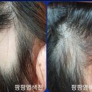 염색팡팡 이미지