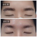 피씨엘김포 | 남자자연눈썹 잘하는 곳 페더링공법 피씨엘코리아 김포 사우동 후기