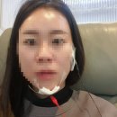 문경환 턱 구강내과 치과의원 | 대구 편한구강내과치과의원 : 턱관절장애 치료_스플린트 제작_내돈내산 솔직후기