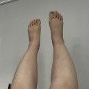 (주)아워홈원주세브란스기독병원점 | [임신39주] 원주 세브란스기독병원 만삭 초산맘 2박3일 유도분만 실패 후 응급제왕 출산후기