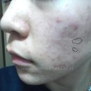 엠티에스 이미지