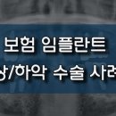 진플란트치과의원 이미지