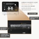 울쎄라피프라임 맞춤형 리프팅 기존 울쎄라 차이 효과 얼마나 달라졌나?