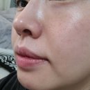 시온뷰티의원 이미지