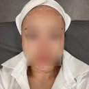모드리헤어 - 동래구 | 압구정역 피부과 인모드리프팅, 사각턱보톡스, 자갈턱보톡스 후기, 주의사항